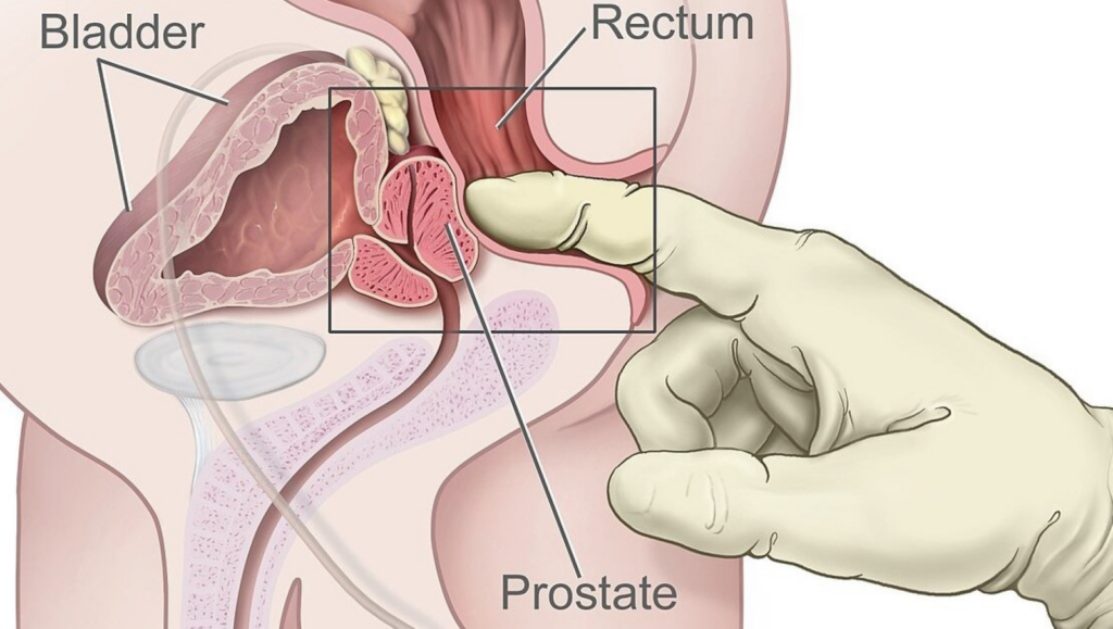 Milking the Prostate – Benefits, Techniques, and Tips